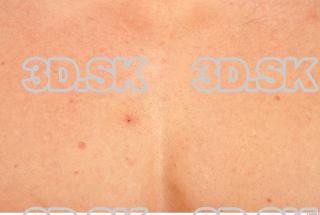 Skin texture of Bystrik 0001